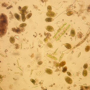 immagine anteprima per la notizia: pubblicato il report sul monitoraggio di ostreopsis cfr. ovata...