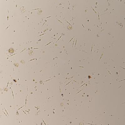 immagine contenuta nella pagina: fioritura algale nel porto di marano lagunare: gli esiti dei con...