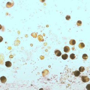 immagine anteprima per la notizia: fitoplancton potenzialmente tossico: il laboratorio di arpa fv...