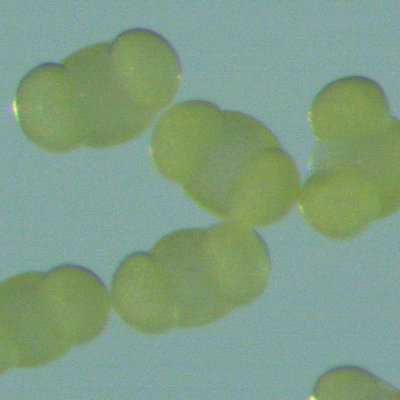 granuli di polline di pinaceae. monfalcone 10 magg...