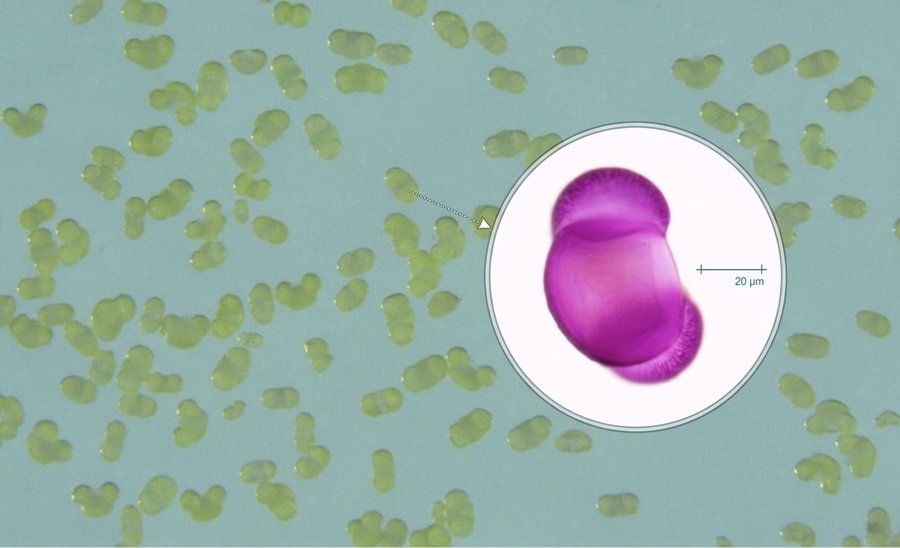 polline di pino marittimo al microscopio, a divers...