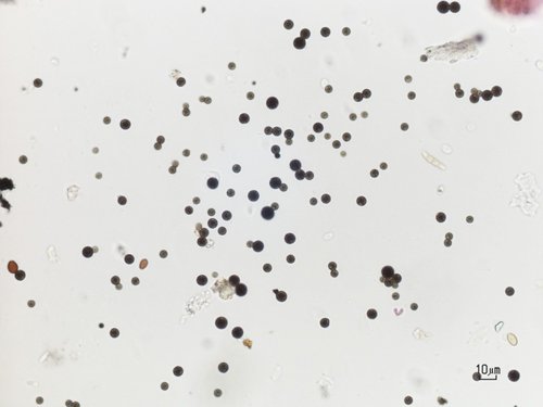 Immagine al microscopio ottico delle particelle aerodisperse raccolte nella nostra regione. Le particelle nere sono di origine carboniosa e contengono anche idrocarburi policiclici aromatici tra i quali il benzo[a]pirene. Quelle “trasparenti” sono di origine crostale o salina